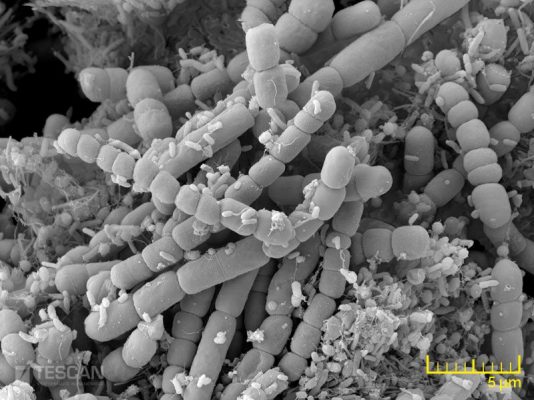Các ứng dụng của kính hiển vi điện tử quét (SEM)